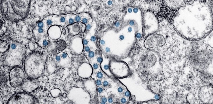 Image: Transmission electron microscopic image of an isolate from the first US case of COVID-19. Credit: CDC/ Hannah A Bullock; Azaibi Tamin.